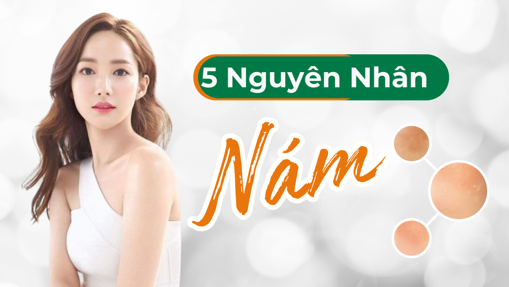 5nguyên nhân khiến da bị nám